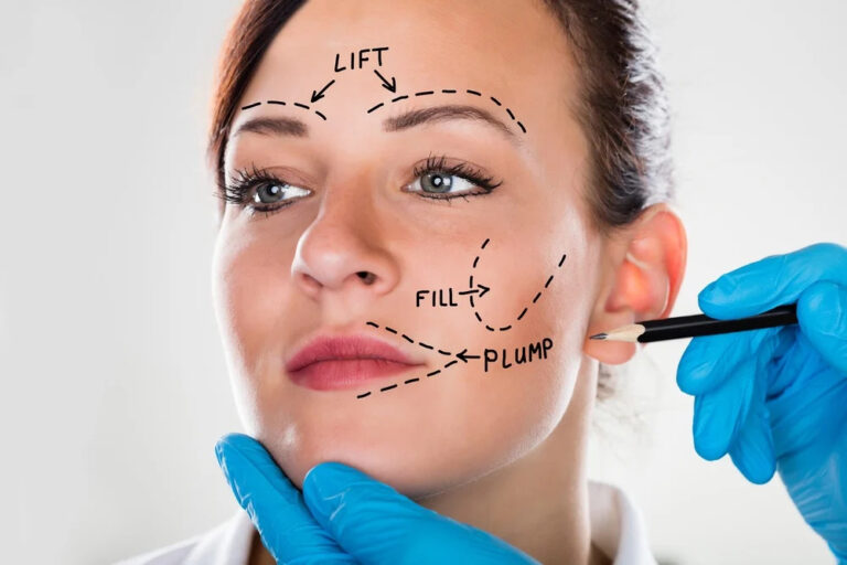 Where to find the best Facelift Surgery in your area?